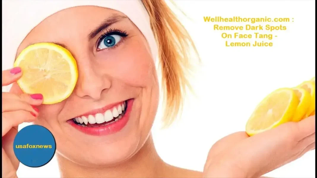 Wellhealthorganic.com Remove Dark Spots On Face Tang - Lemon Juice