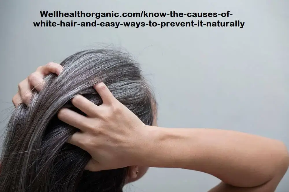 Wellhealthorganic.comknow-the-causes-of-white-hair-and-easy-ways-to-prevent-it-naturally